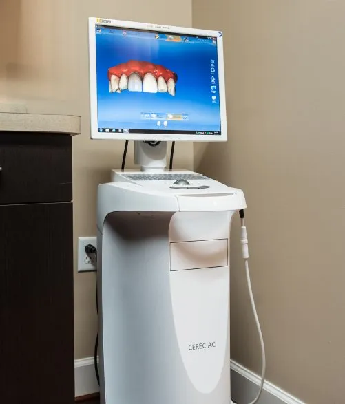 A futuristic looking machine with a cerec scanner and monitor on top